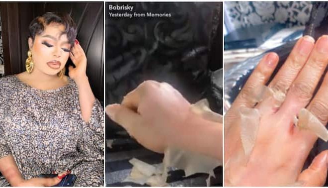 Bobrisky Causes Massive Stir Online After Sharing Photos of His Skin Peeling