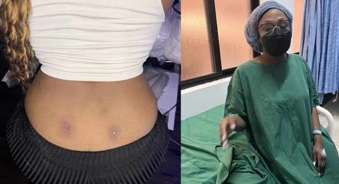 Lady lands in the hospital after getting a back dimple piercing