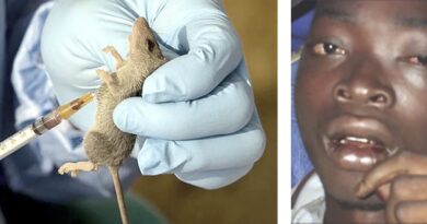 Lassa Fever