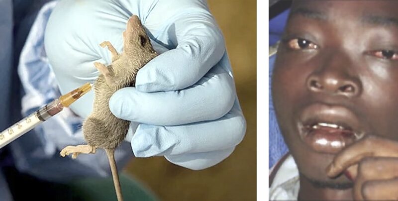 Lassa Fever